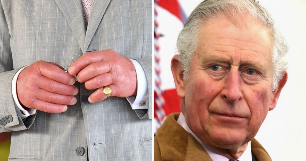 Doctor discusses possible reason behind King Charles' 'sausage' fingers